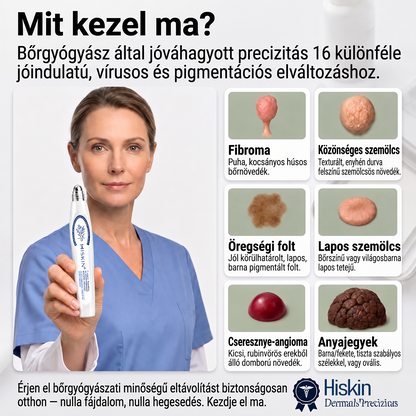 Hivatalos Márkabolt | 🚢 Hiskin® 7 napos Szemölcseltávolító Roll-on Ápoló Folyadék (Fájdalommentes rollerball technológia, hegek nélkül) 🐬