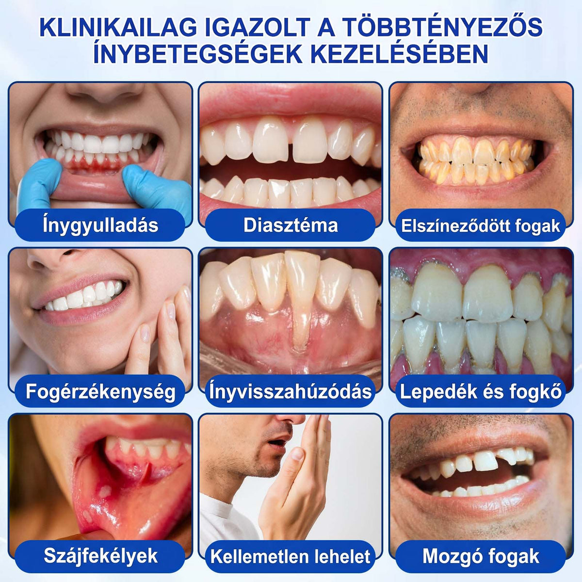 PureShade® 🦷🦷 GumRevive Ínyregeneráló Gél – Az egészségesebb ínyért és magabiztosabb mosolyért 👍