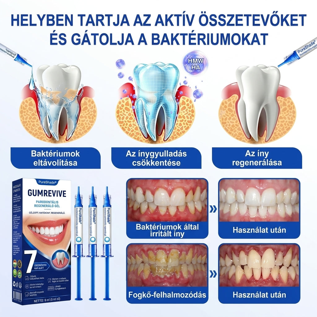 PureShade® 🦷🦷 GumRevive Ínyregeneráló Gél – Az egészségesebb ínyért és magabiztosabb mosolyért 👍