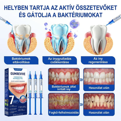 PureShade® 🦷🦷 GumRevive Ínyregeneráló Gél – Az egészségesebb ínyért és magabiztosabb mosolyért 👍