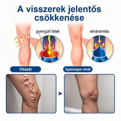 👩‍⚕️👩‍⚕️FFBSI® Visszérápoló Mikrotűs Gondozó Tapasz ⚡ Azonnali Megkönnyebbülés, Hosszú Távú Eredmények