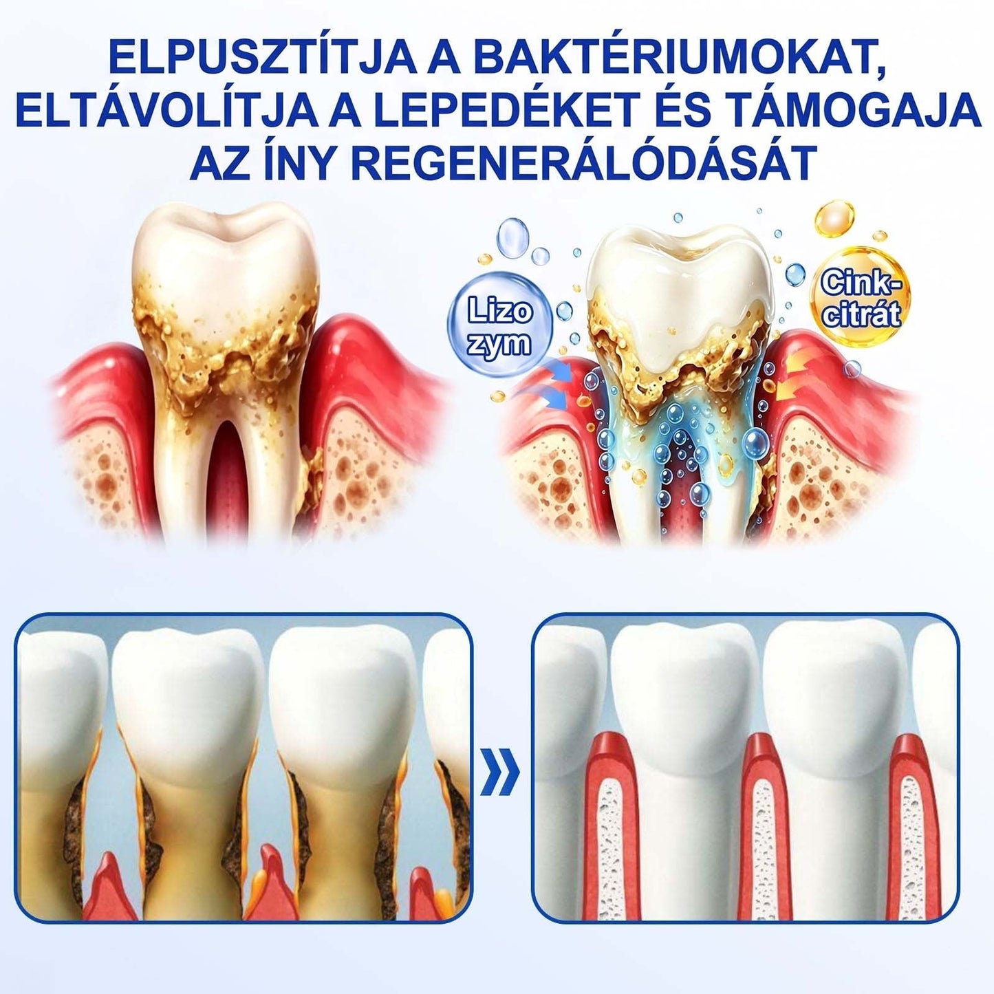PureShade® 🦷🦷 GumRevive Ínyregeneráló Gél – Az egészségesebb ínyért és magabiztosabb mosolyért 👍
