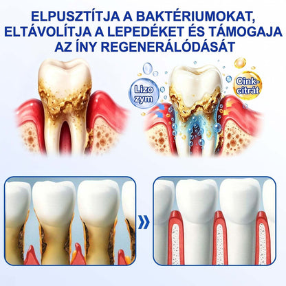 PureShade® 🦷🦷 GumRevive Ínyregeneráló Gél – Az egészségesebb ínyért és magabiztosabb mosolyért 👍